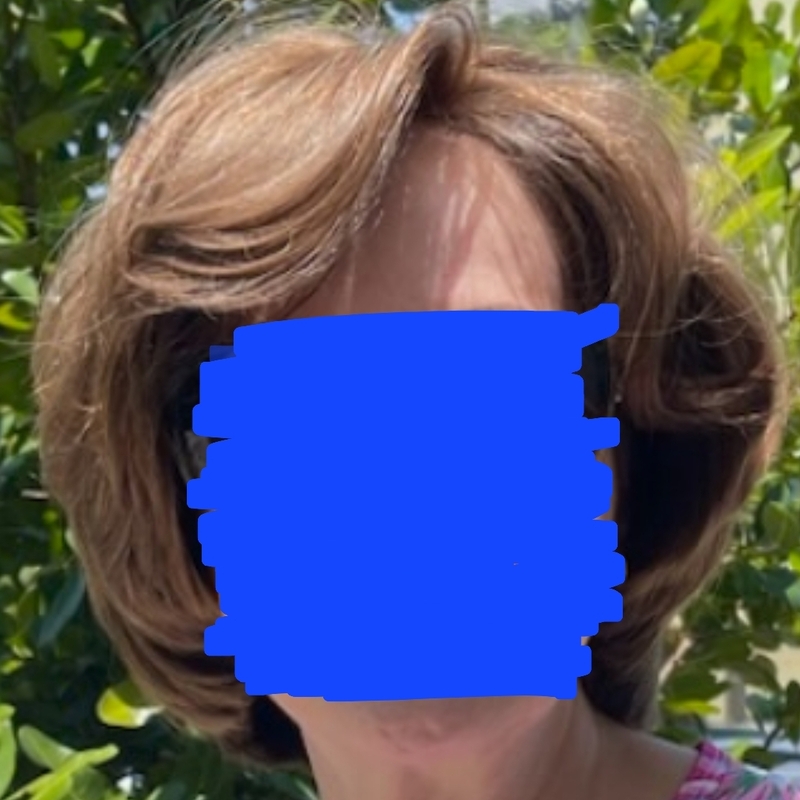 Headpiece for crown.  Client has a lot of hair in perimeter but thinning on top only.